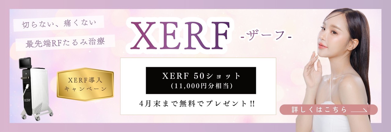 XERF